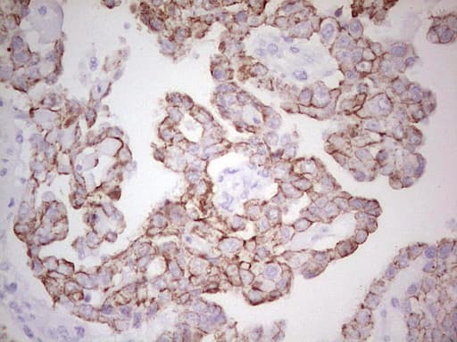 ABCB1 / MDR1 / P Glycoprotein Antibody (aa995-1280, clone OTI8A9)
