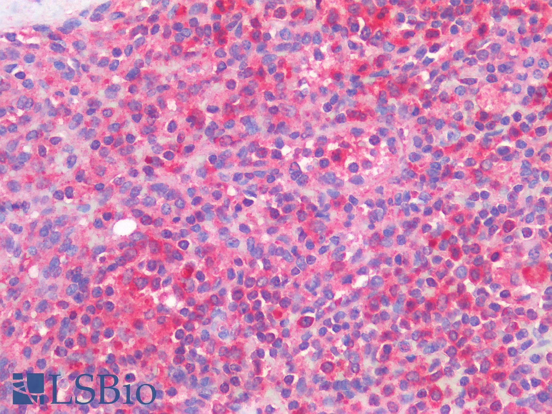 IHC-plus™ Polyclonal Rabbit anti-Human CD33 Antibody (IHC)