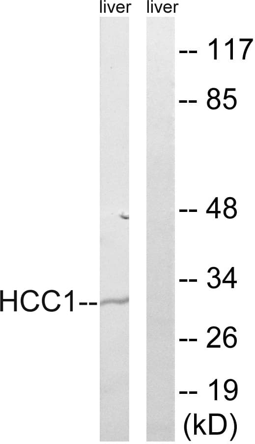 SARNP / Hcc-1 / CIP29 Antibody (aa147-196)
