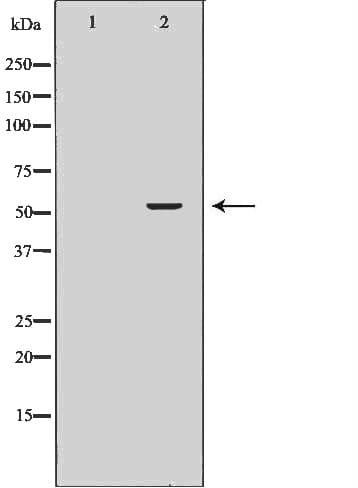 SLC1A4 / ASCT1 Antibody