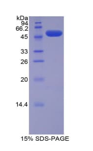 Mouse SLC27A5 / BACS Protein (Recombinant His-GST)