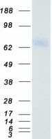 Human F2 / Prothrombin / Thrombin Protein (Recombinant Myc-DDK (Flag))