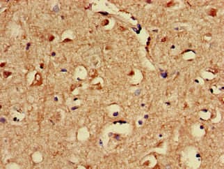SPRED1 Antibody
