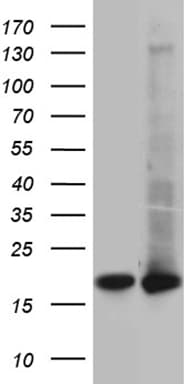 Monoclonal Mouse anti-Human UBE2D4 Antibody (clone OTI1B1, IHC, WB)