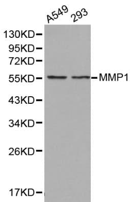 Polyclonal Rabbit anti-Human MMP1 Antibody (IHC, WB)