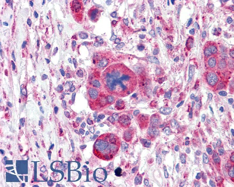 PathPlus™ Polyclonal Rabbit anti-Human GLP1R / GLP-1 Receptor Antibody (N-Terminus, IHC, IF, WB)