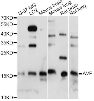 Polyclonal Rabbit anti-Human AVP / ADH / Vasopressin Antibody (IHC, WB)