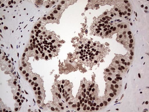 SAE1 Antibody (clone OTI3C3)