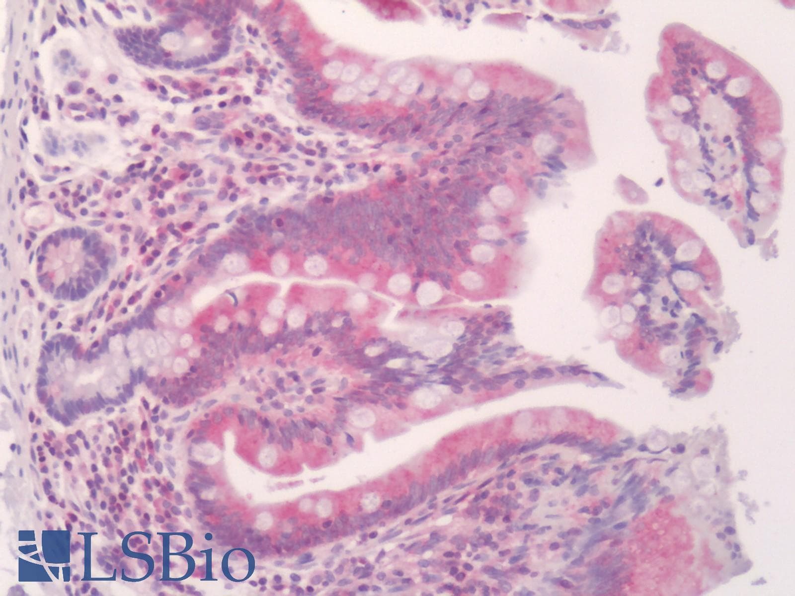 IHC-plus™ TNFRSF14 / CD270 / HVEM Antibody