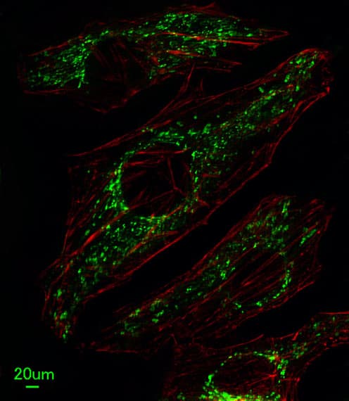 IHC-plus™ SLC25A37 / Mitoferrin Antibody (aa309-338)