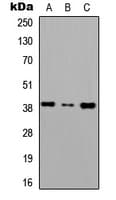 CXCR6 Antibody (N-Terminus)