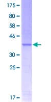 Human TWIST1 / TWIST Protein (Recombinant GST, N-terminus)