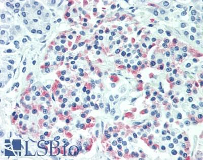 IHC-plus™ TRIM21 / RO52 Antibody (aa425-475)