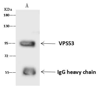 Polyclonal Rabbit anti-Human HCCS1 / VPS53 Antibody (WB)
