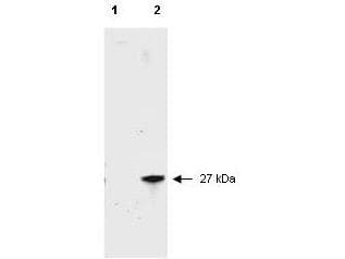 RFP / Red Fluorescent Protein Antibody (FITC)