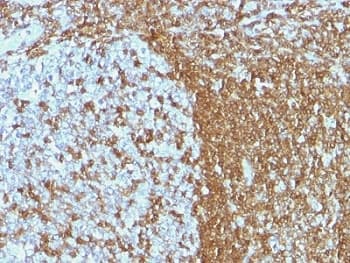 ICAM3 / CD50 Antibody (clone ICAM3/1019)