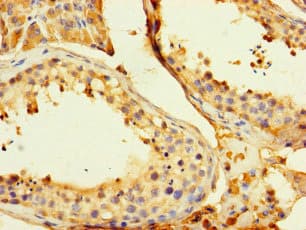 Polyclonal Rabbit anti-Human GPD2 Antibody