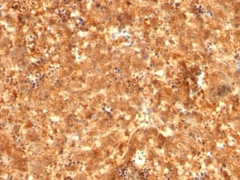 Monoclonal Mouse anti-Human Alpha-Fetoprotein Antibody (clone C2 + C3 + MBS-12, IHC, IF)