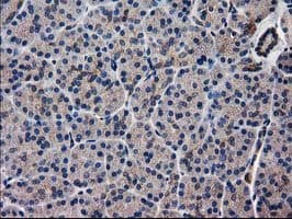 Monoclonal Mouse anti-Human ARFGAP1 Antibody (clone OTI1F6, IHC, IF, WB)