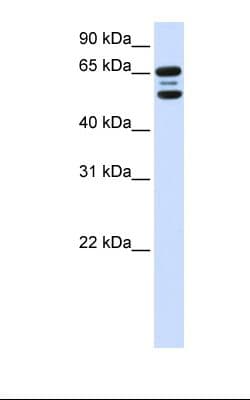 FBXO21 Antibody (aa74-123)