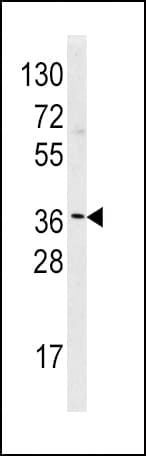 HMT / HNMT Antibody (aa29-58)