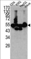 CPN1 Antibody (aa52-81)