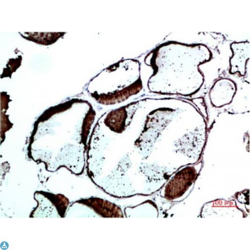 TTR / Transthyretin Antibody