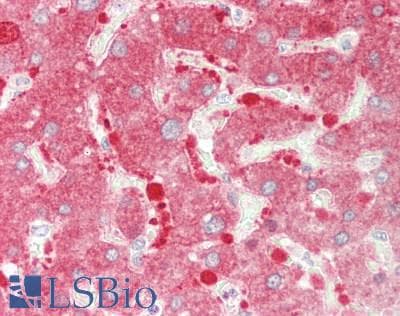 Polyclonal Rabbit anti-Human PDE1A Antibody (C-Terminus, IHC, WB)
