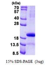 Human PAEP / Glycodelin / GdF Protein (Recombinant His)