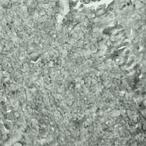 Polyclonal Rabbit anti-Human SYT17 Antibody (Internal, IHC, WB)