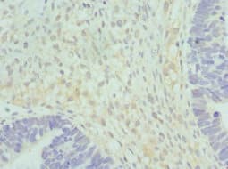 HSD17B2 Antibody