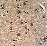GGTLA1 / GGT5 Antibody (aa130-156)