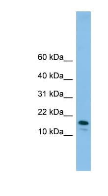 GREM2 / Gremlin 2 Antibody (N-Terminus)