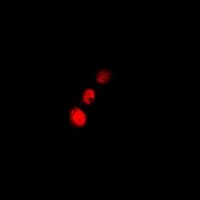 Polyclonal Rabbit anti-Human CFL2 / Cofilin 2 Antibody (IF, WB)