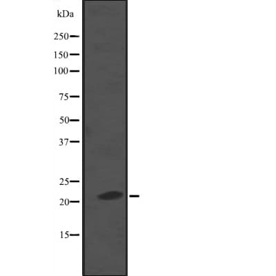 NKIRAS2 Antibody
