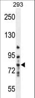 MMP9 / Gelatinase B Antibody (aa644-673)