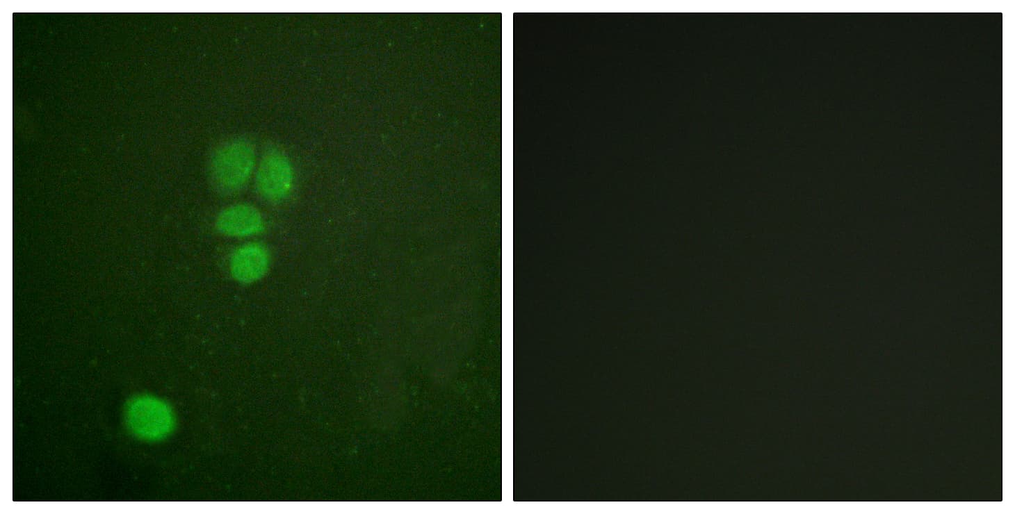 IHC-plus™ Polyclonal Rabbit anti-Human SOX9 Antibody (aa147-196, IHC, IF, WB)