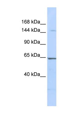 Polyclonal Rabbit anti-Human RERE Antibody (aa36-85, WB)