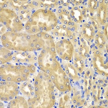 Polyclonal Rabbit anti-Human XIAP Antibody (IHC, IF, WB)