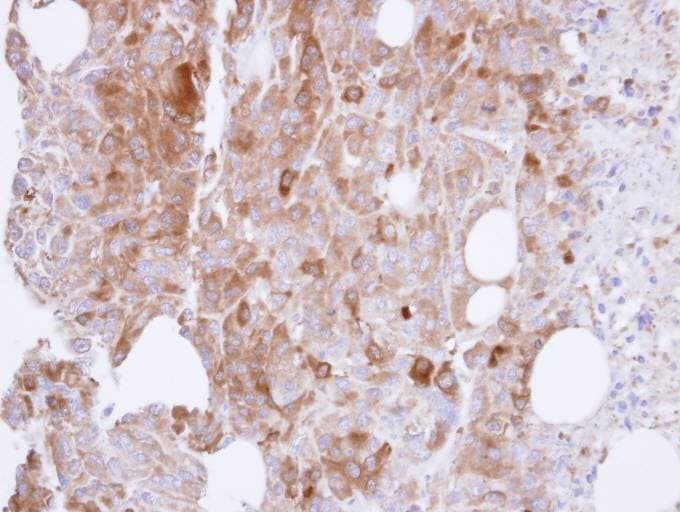 Polyclonal Rabbit anti-Human UAP1 Antibody (aa53-473, IHC, WB)