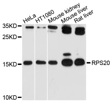RPS20 / Ribosomal Protein S20 Antibody