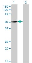 Monoclonal Mouse anti-Human ZNF213 Antibody (clone 5D7, IHC, WB)