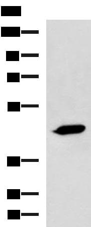 Polyclonal Rabbit anti-Human ASB10 Antibody (WB)
