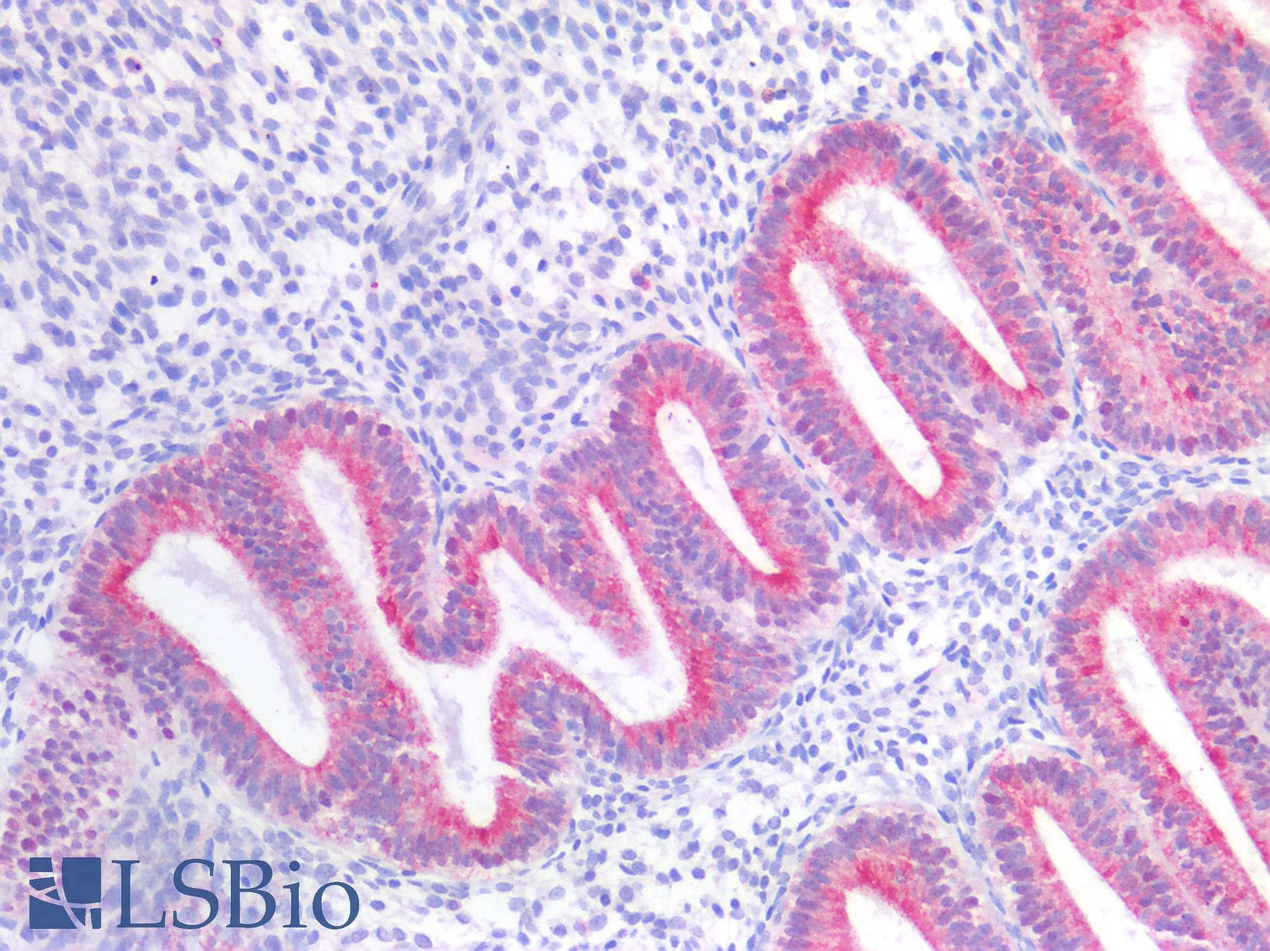 PathPlus™ GPR87 Antibody (N-Terminus)