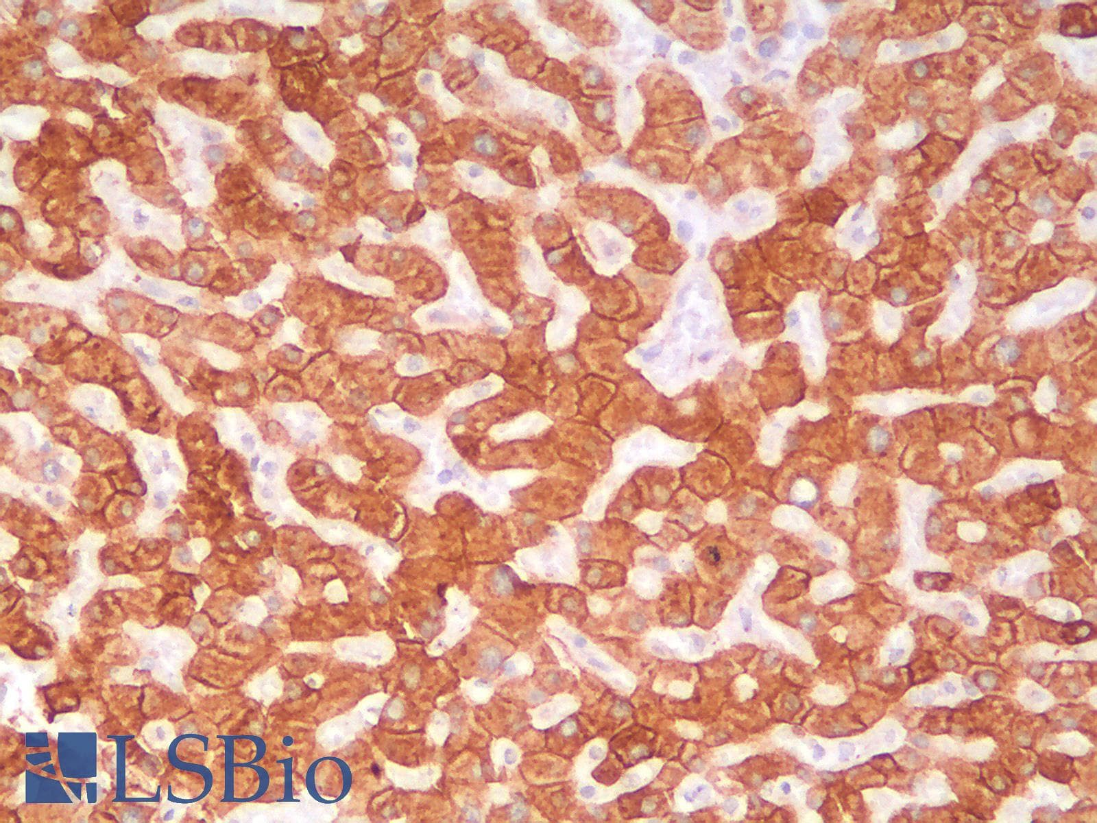IHC-plus™ KRT18 / CK18 / Cytokeratin 18 Antibody (clone KRT18/2819R)