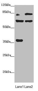 Polyclonal Rabbit anti-Human MTO1 Antibody (IHC, WB)