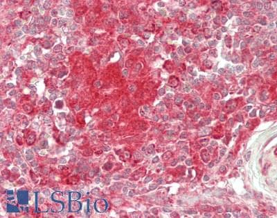 IHC-plus™ IL1RN Antibody