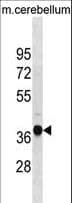 UBLCP1 Antibody (aa102-128)