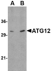 APG12 / ATG12 Antibody