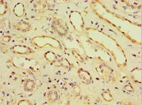 IHC-plus™ CDH11 / Cadherin 11 Antibody (aa637-796)
